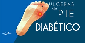 Úlceras del pie diabético 