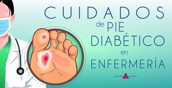 Cuidados de pie diabético en enfermería